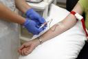 Is there a two-tier service for blood tests between Suffolk and Essex?